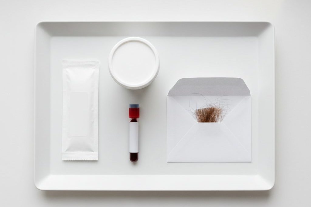 Overhead view of urine cup, swab, blood vial and hair envelope arranged on a tray
